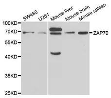 Anti ZAP 70 Antibody gallery image 1