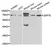 Anti ZAP 70 Antibody thumbnail image 1