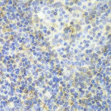 Anti ZAP 70 Antibody gallery image 2