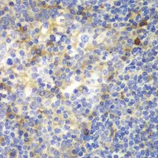 Anti ZAP 70 Antibody gallery image 3