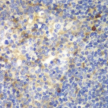 Anti ZAP 70 Antibody gallery image 3