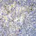 Anti ZAP 70 Antibody thumbnail image 3