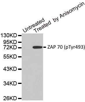 Anti ZAP 70 (pTyr493) Antibody gallery image 1