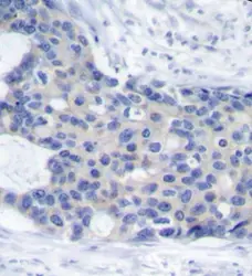 Anti ZAP 70 (pTyr493) Antibody gallery image 2