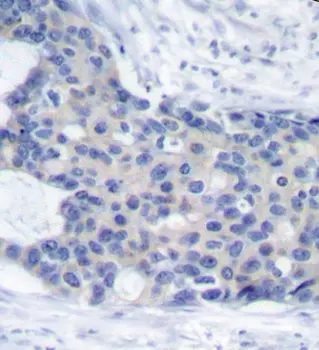 Anti ZAP 70 (pTyr493) Antibody gallery image 2