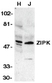 Anti Human ZIP Kinase (aa279-298) Antibody thumbnail image 1