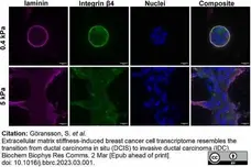 Anti Laminin Antibody gallery image 2