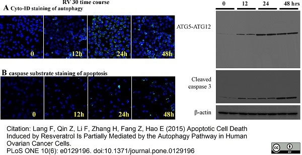 Anti ATG5-ATG12 Complex (C-Terminal) Antibody gallery image 1
