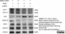 Anti ATG5-ATG12 Complex (C-Terminal) Antibody gallery image 2