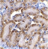 Anti Mouse CAD (aa205-222) Antibody gallery image 2
