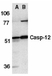 Anti Caspase-12 (aa2-17) Antibody thumbnail image 2