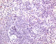 Anti Mouse CD197 Antibody gallery image 2