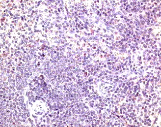Anti Mouse CD197 Antibody gallery image 2