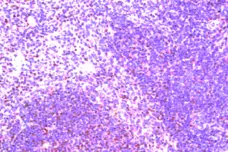 Anti Mouse CDw198 Antibody gallery image 1
