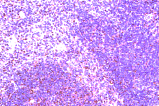 Anti Mouse CDw198 Antibody gallery image 1