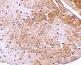 Anti Mouse CIDE-A (aa200-214) Antibody gallery image 2