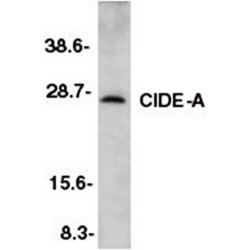 Anti Mouse CIDE-A (aa200-214) Antibody gallery image 1