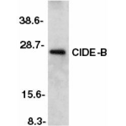 Anti Mouse CIDE-B (aa204-219) Antibody gallery image 1
