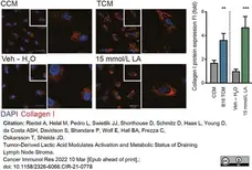 Anti Mouse Collagen I Antibody gallery image 1