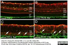 Anti Mouse Collagen IV Antibody gallery image 1