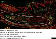Anti Mouse Collagen IV Antibody gallery image 16