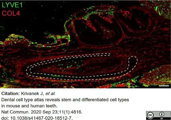Anti Mouse Collagen IV Antibody gallery image 17