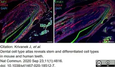 Anti Mouse Collagen IV Antibody gallery image 18