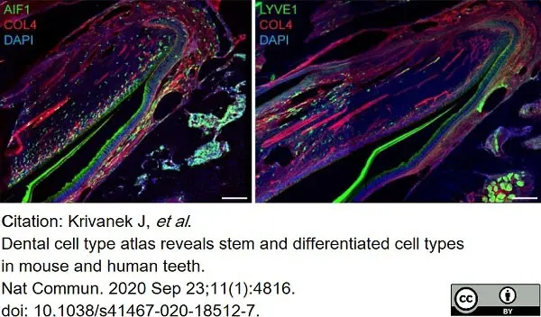 Anti Mouse Collagen IV Antibody gallery image 18