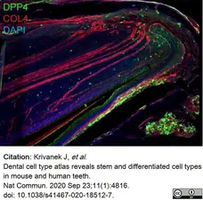 Anti Mouse Collagen IV Antibody gallery image 19