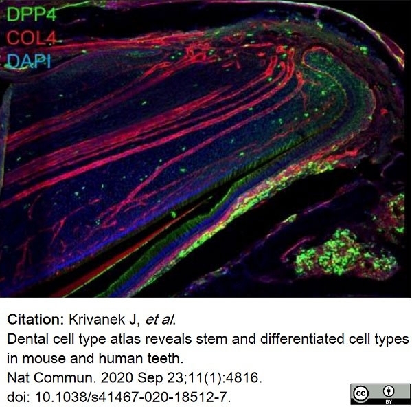 Anti Mouse Collagen IV Antibody gallery image 19