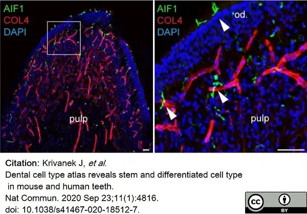 Anti Mouse Collagen IV Antibody gallery image 20