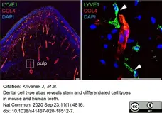 Anti Mouse Collagen IV Antibody gallery image 21