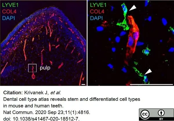 Anti Mouse Collagen IV Antibody gallery image 21