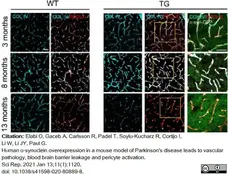 Anti Mouse Collagen IV Antibody gallery image 22