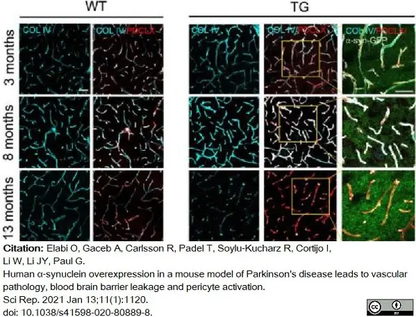 Anti Mouse Collagen IV Antibody gallery image 22