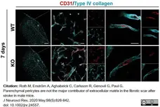Anti Mouse Collagen IV Antibody gallery image 26