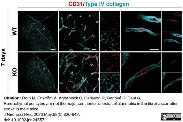 Anti Mouse Collagen IV Antibody gallery image 26