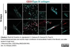 Anti Mouse Collagen IV Antibody gallery image 27