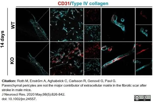 Anti Mouse Collagen IV Antibody gallery image 27