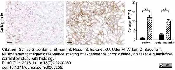 Anti Mouse Collagen IV Antibody gallery image 30