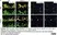 Anti Mouse Collagen IV Antibody thumbnail image 31