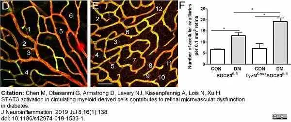 Anti Mouse Collagen IV Antibody gallery image 33