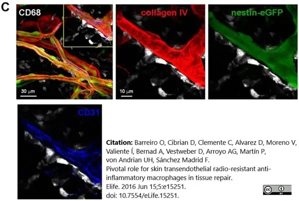 Anti Mouse Collagen IV Antibody gallery image 39
