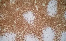 Anti Mouse IgG1 Antibody - 0.5mg gallery image 1