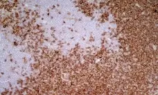 Anti Mouse IgG1 Antibody - 0.5mg gallery image 2