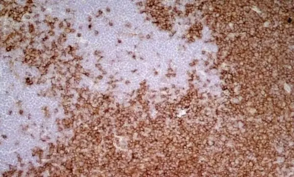 Anti Mouse IgG1 Antibody - 0.5mg gallery image 2