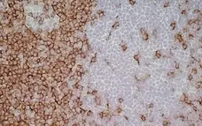 Anti Mouse IgG1 Antibody - 0.5mg gallery image 21
