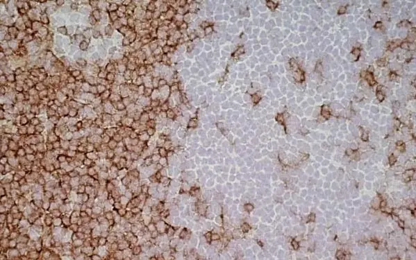 Anti Mouse IgG1 Antibody - 0.5mg gallery image 21