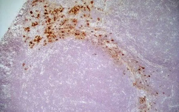 Anti Mouse IgG1 Antibody - 0.5mg gallery image 4