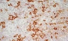 Anti Mouse IgG1 Antibody - 0.5mg gallery image 5